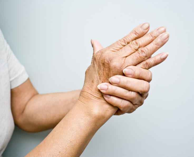 Elderly woman holding her arthritic hands